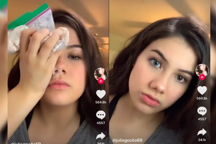 The Bright Eye Challenge