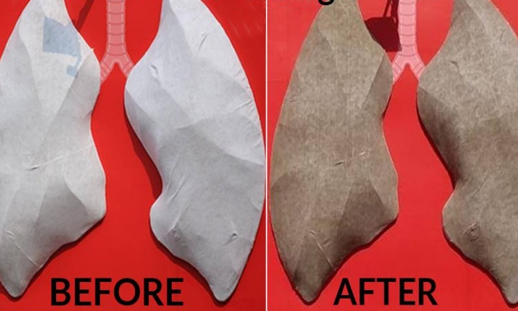 Delhi’s Air Pollution Caused A Clean Pair Of Lungs To Turn Black After Six Days