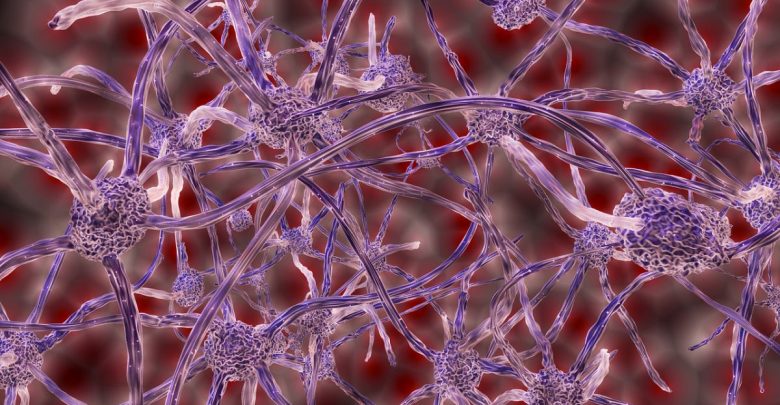 Rerouting Nerves To Reduce Amputees' Phantom Limb Syndrome