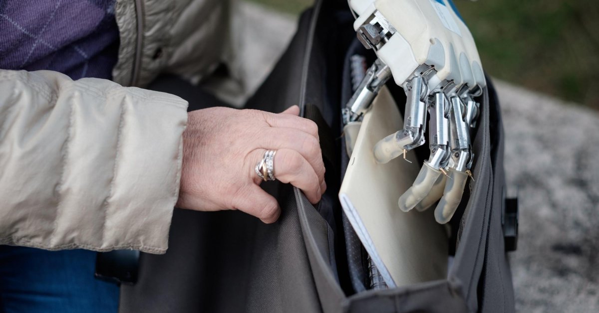 With This Prosthesis, Amputees Can Have Feelings Like A Real Arm
