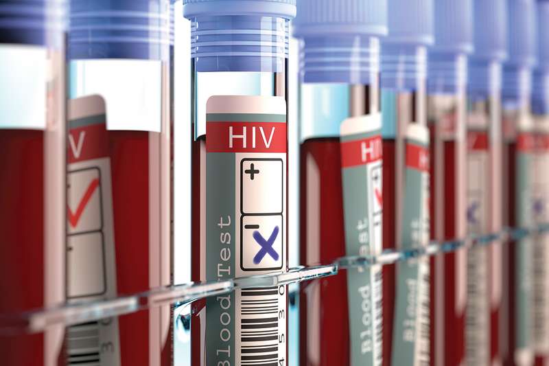 The World Has Just Welcome A Third Patient Who Has Been Cured Of HIV