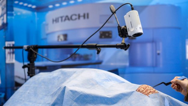 A Doctor Used 5G To Direct A Surgery Remotely From MWC's Stage