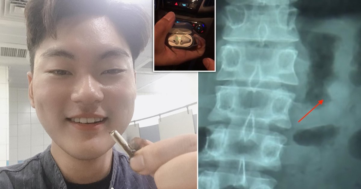 A Man Swallowed An AirPod And The Earbud Still Worked After Going Through His System