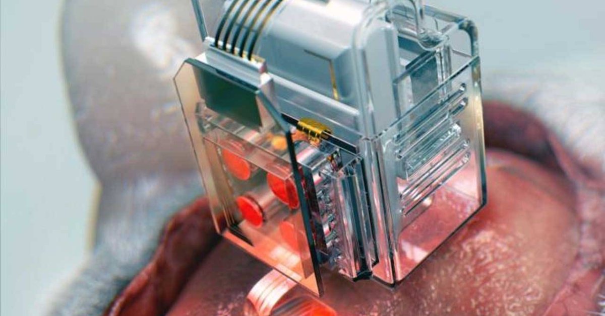 This Neural Implant Allows Scientists To Manipulate Human Brain Cells With A Smartphone