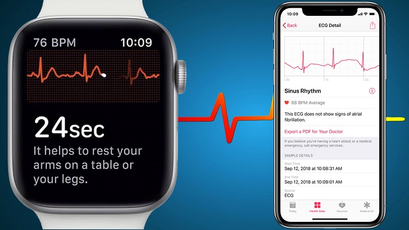 iphone watch 4 ecg