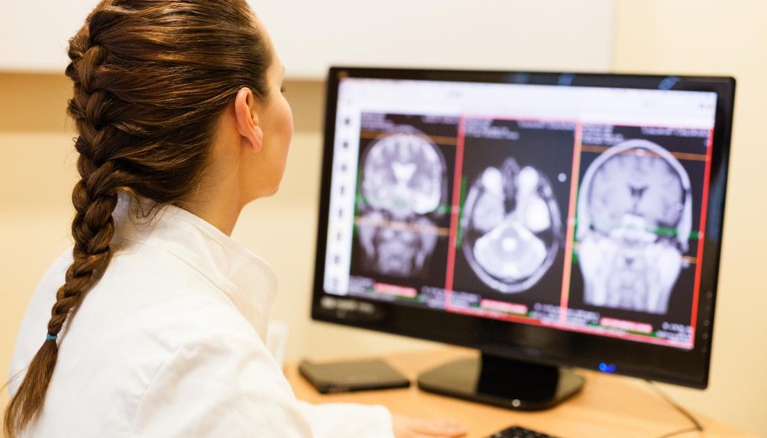 AI Will Soon Help Doctor To Diagnose Brain Hemorrhages