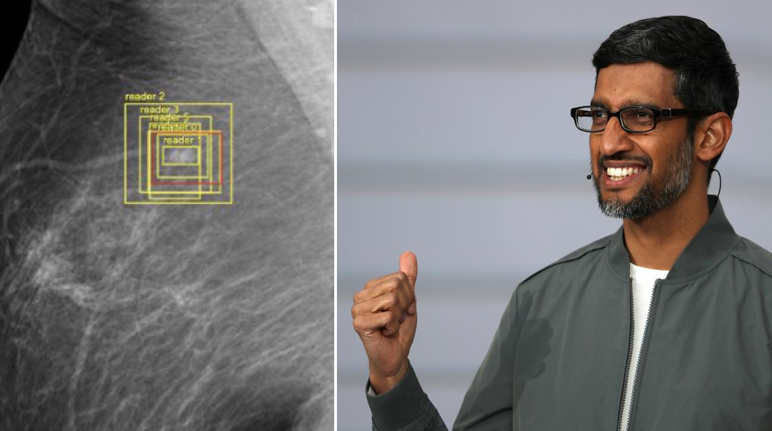Google's AI May Replace Doctors In Detecting Breast Cancer Because It's More Accurate