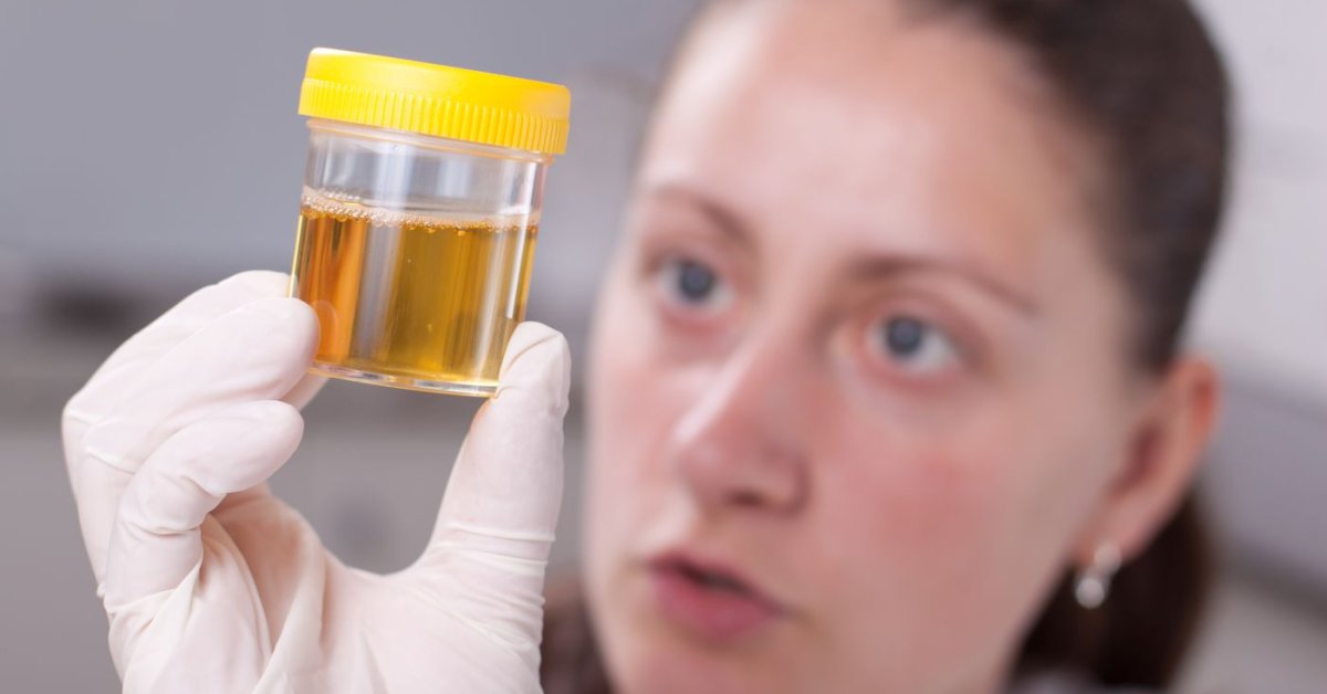 This Woman's Body Naturally Brews And Urinates Alcohol