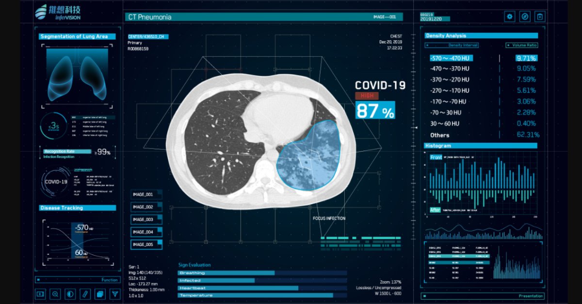 E-Commerce Giant Alibaba Trains AI To Diagnose COVID-19 In Seconds
