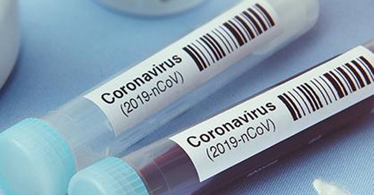 Тест ковид пробирка. ПЦР тест на коронавирус. Covid. Covid-19. Covid 19 б