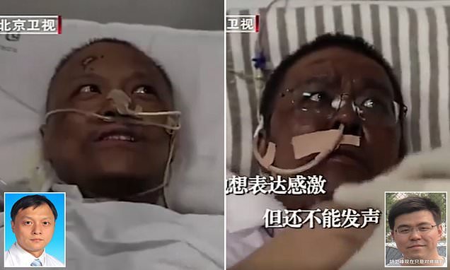 Two Chinese Doctors Wake Up With Darkened Skin After COVID-19 Recovery
