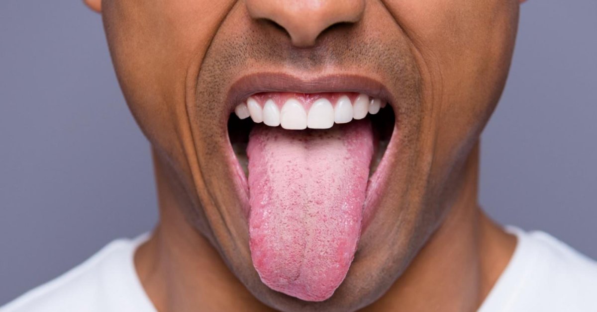 Hindu Man Cuts Off His Tongue To Stop The Spread Of COVID-19 - MobyGeek.com