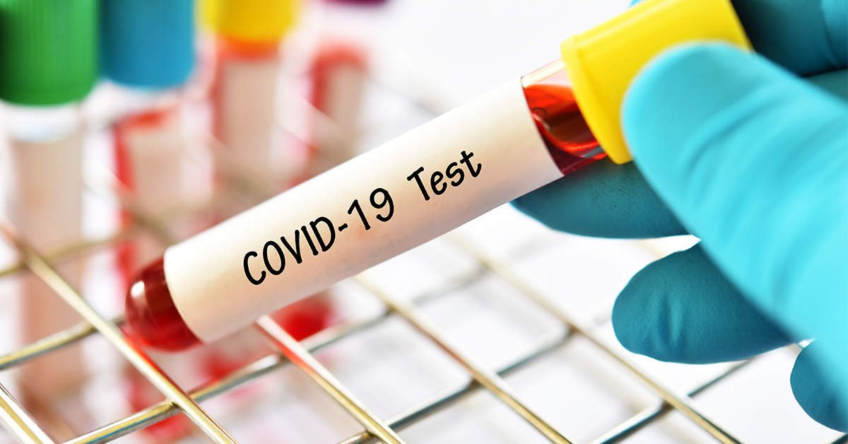 Scientists Introduce New COVID-19 Testing Method 8 Times More Efficient Than Individual Testing
