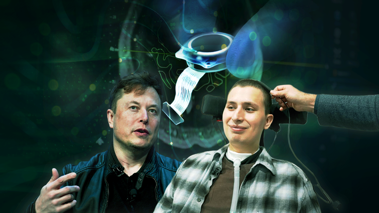 Elon Musk Highlights Neuralink Breakthrough with New Surgical Robot for Brain Implants