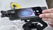 Turning Old Phones Into Microscopes, This Project Will Help A Lot Of Poor Children