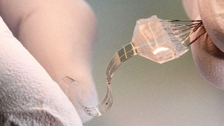 Regaining The Ability To Walk In A Paralysis Man With Electrical Stimulation