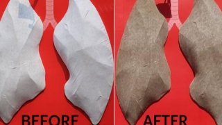 Delhi’s Air Pollution Caused A Clean Pair Of Lungs To Turn Black After Six Days