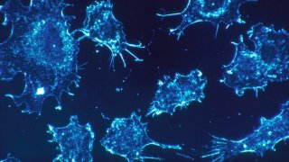 Scientists Have Found A Potential Method To Detect Cancer