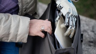 With This Prosthesis, Amputees Can Have Feelings Like A Real Arm