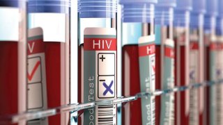 The World Has Just Welcome A Third Patient Who Has Been Cured Of HIV