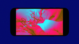 First Ever 5G Surgery Done At The Mobile World Congress 2019