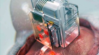 This Neural Implant Allows Scientists To Manipulate Human Brain Cells With A Smartphone