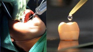 Scientists Created A Gel That Allows Your Teeth Repair Themselves