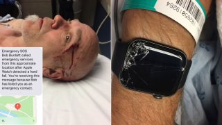 Apple Watch Saved Man’s Life By Automatically Dialing The Emergency