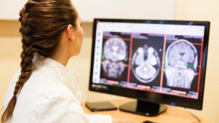 AI Will Soon Help Doctor To Diagnose Brain Hemorrhages