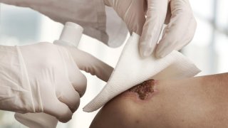 This Smart Bandage Can Change Colors According To Bacteria Infection Level