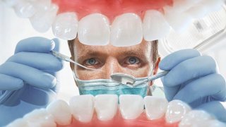 Bacteria Has Invaded Your Tongue And Here's What It Looks Like