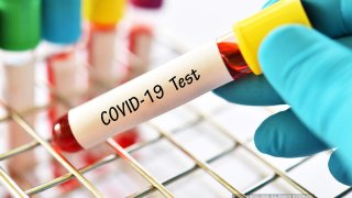 Scientists Introduce New COVID-19 Testing Method 8 Times More Efficient Than Individual Testing