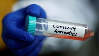 69YO Virologist Voluntarily Contracts COVID-19 To Test His Immunity