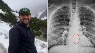 Apple AirPod Still Works After Being Swallowed Into Stomach