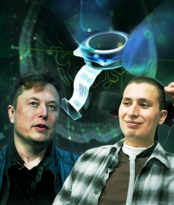Elon Musk Highlights Neuralink Breakthrough with New Surgical Robot for Brain Implants