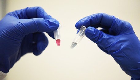 It Now Takes 10 Minutes To Diagnose Cancer At 90 Percent Accuracy