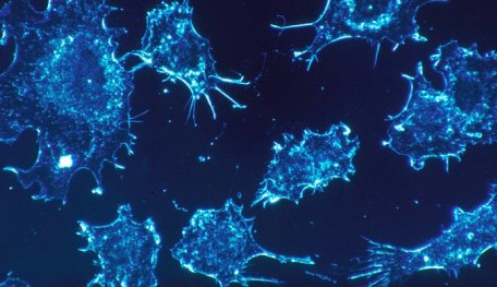 Scientists Have Found A Potential Method To Detect Cancer