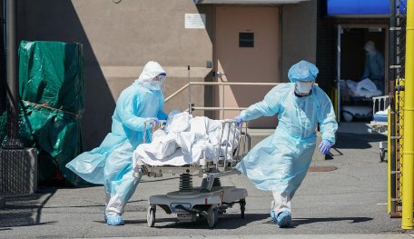 A CO.VID-19 Patient Tragically Died With A Burst Open Heart Due To The Virus' Attack