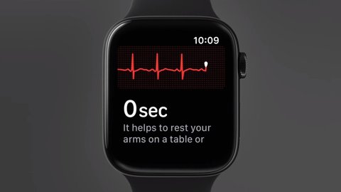 Apple-Watch-ECG-feature