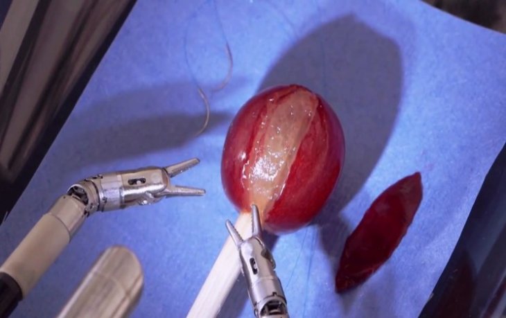 15 Medical Robots That Are Changing the World