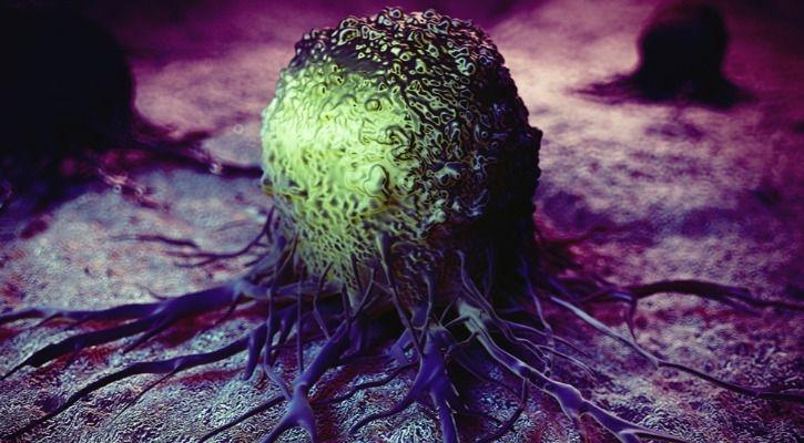 cancer cells