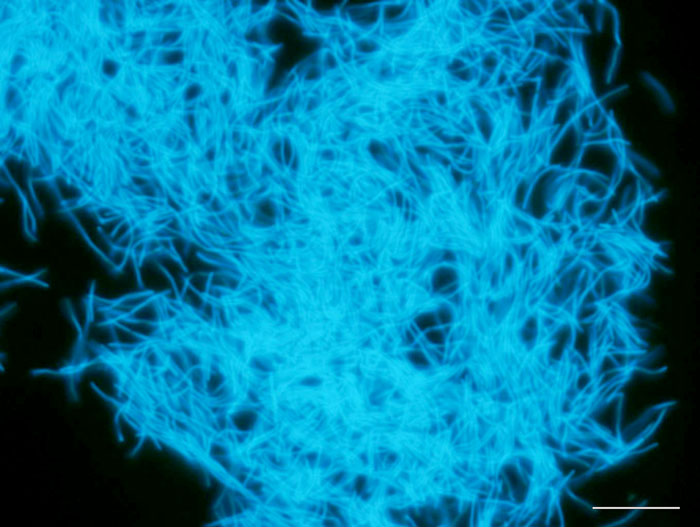 4 Dco Methanobacterium Sp