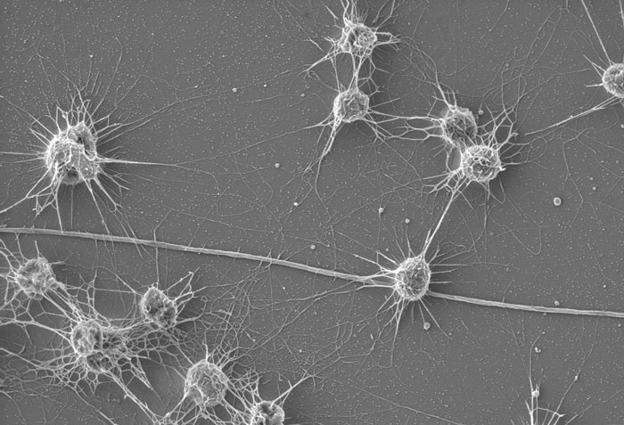 5 Dco Altiarchaeales Biofilm
