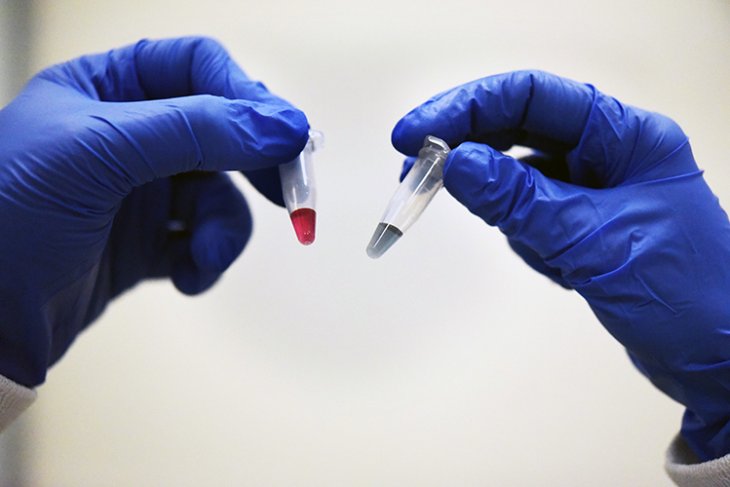 Universal Dna Nano Signature Cancer Trau Aibn 2