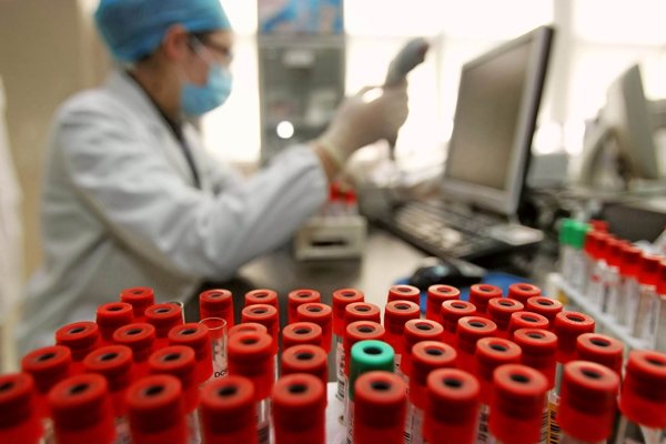 Kết quả hình ảnh cho HIV lab