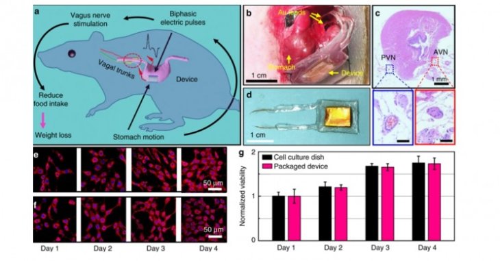 Scientists Develop Neural Weight Loss Implant Smaller than A Centimeter