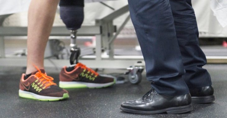 Rerouting Nerves Can Reduce Phantom Limb Syndrome For Amputees