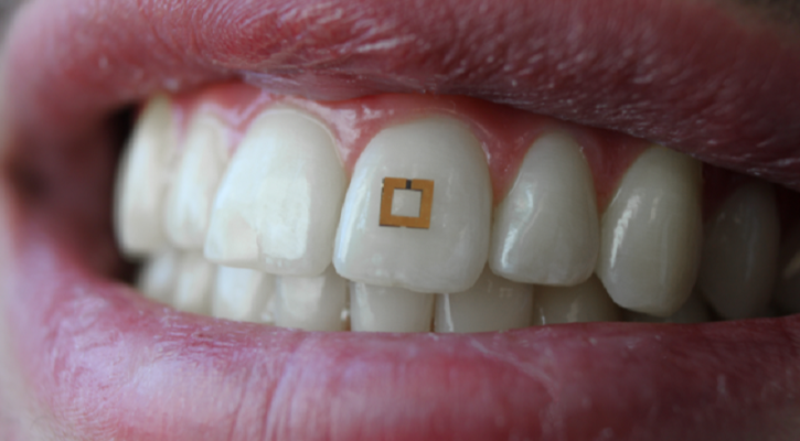 Tooth Sensor 1547638471