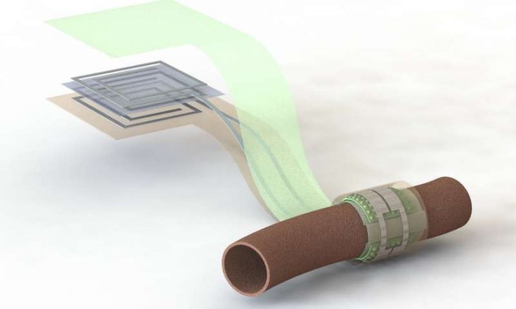 Kết quả hình ảnh cho A new sensor which is battery-free can monitor the pulse of blood flow in our arteries
