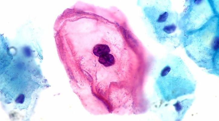 Medical Breakthroughs 1551883503